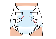 下のテープをハの字の形に止めたイラスト